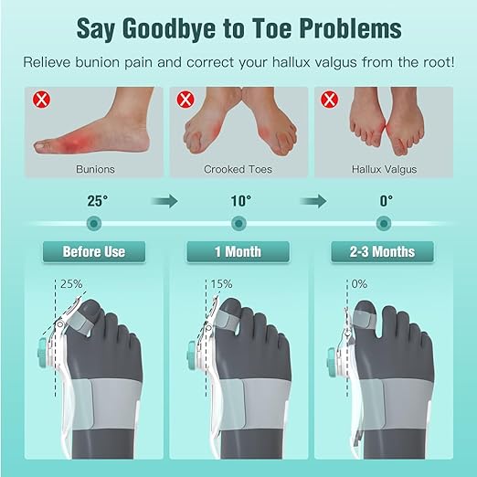 TENICORE Bunion Corrector for Women Men Big Toe, Adjustable Knob Bunion Splint for Bunion Relief, Orthopedic Toe Straightener