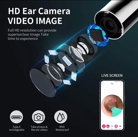 Wireless Ear Cleaner with Camera, 6 LED Lights, 3.6mm Lens, Earwax Removal Tool, Camera for Taking HD Video Photos Earpick Gifts