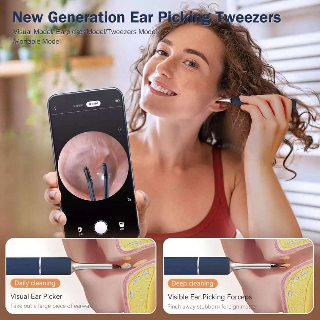4 in 1 Ear Tweezers with Camera | Ear Camera Otoscope with Light