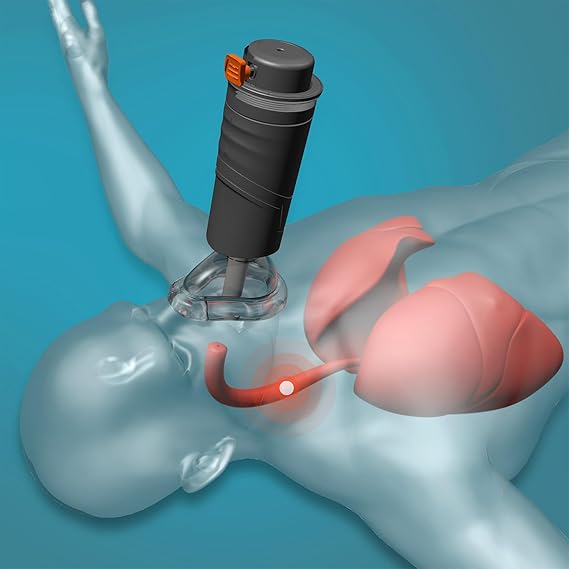 Sonmol Blockage Alleviation Device with 3 Masks | Home Kit with Wall Mount & Dust-Proof Bag…